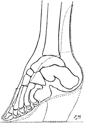 Skeleton of Foot