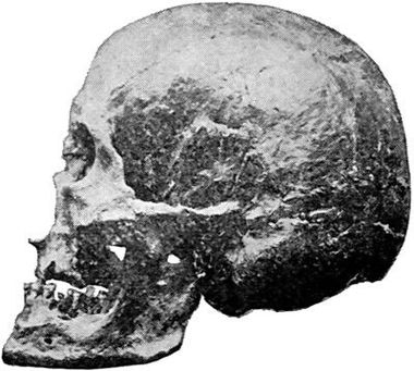 Chancelade Skull