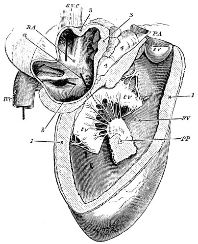 Image unavailable: Fig. 8.—Right Side of the Heart of a Sheep.

R.A. cavity of right auricle; S.V.C. superior vena cava;
I.V.C. inferior vena cava; (a piece of whalebone has been passed
through each of these;) a, a piece of whalebone passed from the
auricle to the ventricle through the auriculo-ventricular orifice;
b, a piece of whalebone passed into the coronary vein.

R.V. cavity of right ventricle; tv, tv, two flaps of the
tricuspid valve: the third is dimly seen behind them, the a,
piece of whalebone, passing between the three. Between the two
flaps, and attached to them by chordæ tendineæ, is seen a
papillary muscle, PP, cut away from its attachment to that
portion of the wall of the ventricle which has been removed. Above,
the ventricle terminates somewhat like a funnel in the pulmonary
artery, P.A. One of the pockets of the semilunar valve, sv, is
seen in its entirety, another partially.

1, the wall of the ventricle cut across; 2, the position of the
auriculo-ventricular ring; 3, the wall of the auricle; 4, masses of
fat lodged between the auricle and pulmonary artery.