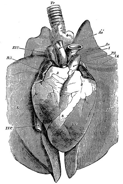 Image unavailable: Fig. 5.&mdash;Heart of Sheep, as seen after Removal from the Body,
lying upon the Two Lungs. The Pericardium has been cut away, but no
other Dissection made.

R.A. Auricular appendage of right auricle; L.A. auricular appendage
of left auricle; R.V. right ventricle; L.V. left ventricle; S.V.C.
superior vena cava; I.V.C. inferior vena cava; P.A. pulmonary
artery; Ao, aorta; Áó, innominate branch from aorta dividing into
subclavian and carotid arteries; L. lung; Tr. trachea. 1, solid cord
often present, the remnant of a once open communication between the
pulmonary artery and aorta. 2, masses of fat at the bases of the
ventricle hiding from view the greater part of the auricles. 3, line of
fat marking the division between the two ventricles. 4, mass of fat
covering the trachea.