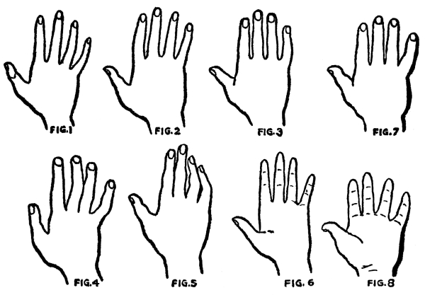 HAND SHAPE