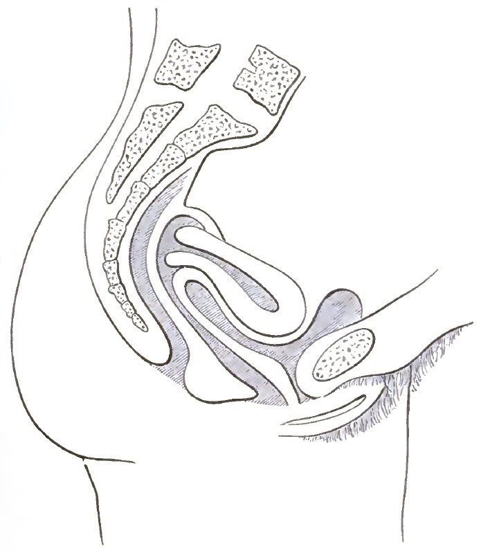 Pathological anteversion