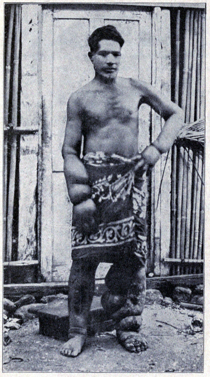 A LEPER OF TAHITI