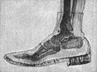A X-ray
photograph of a human foot inside a shoe, revealing the bones of the
ankle and toes — an early demonstration of Röntgen's discovery, showing
the diagnostic potential of X-rays through solid material.
